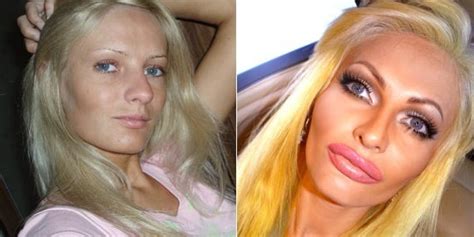 Model Spends Thousands On Plastic Surgery To Look Like A Sex Doll Says She S Happy And