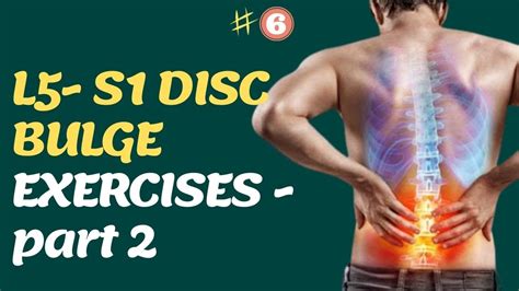 L5 S1 Disc Bulge Exercises Degenerative Disc Disease Sciatica