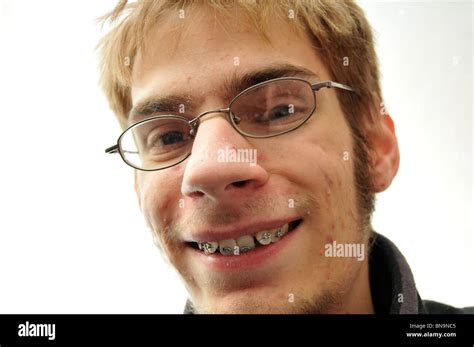 Ugly Smile Hi Res Stock Photography And Images Alamy