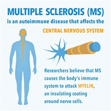 What You Must Know About Multiple Sclerosis Stem Cell Research