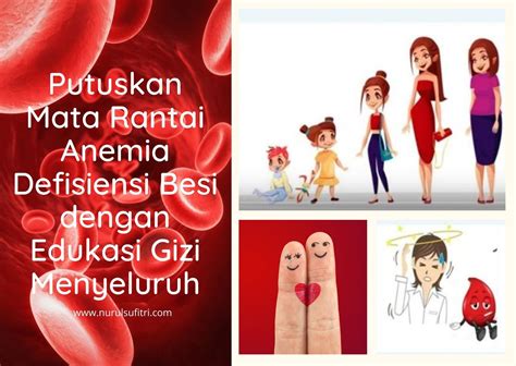 Putuskan Mata Rantai Anemia Defisiensi Besi Dengan Edukasi Gizi