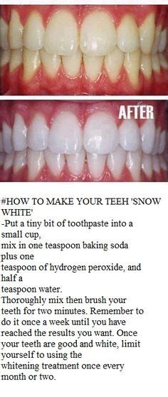 Teeth Whitening Home Remedy Ok When I First Saw This I