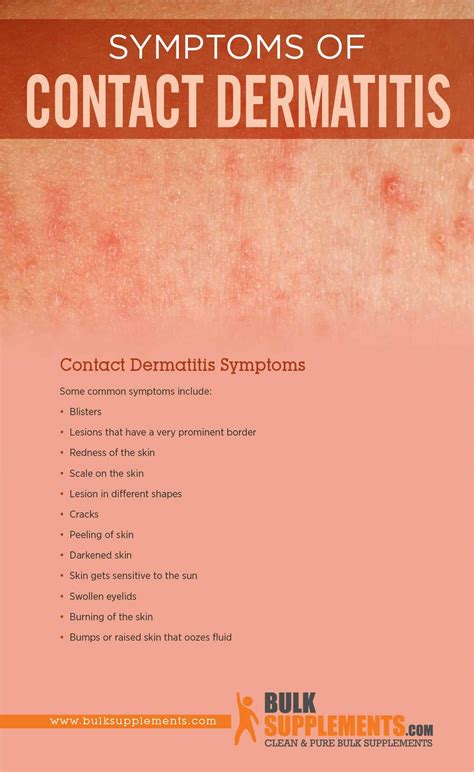 Mild Contact Dermatitis