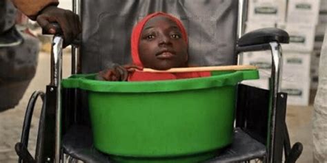 Limbless Teen Who Lived Her Entire Life Inside A Plastic Bucket Passes