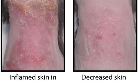 How The Skin Becomes Inflamed