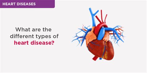 Types Of Heart Disease Risk Factors Treatment And More Gerard Leong
