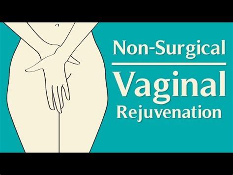 Non Surgical Vaginal Rejuvenation Surgeon Minute YouTube