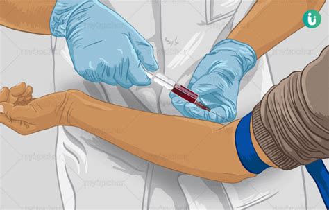Arterial Blood Gases Procedure Arterial Blood Gas Abg Procedure Osce Demonstration Check