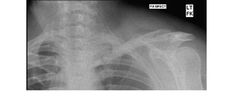 Follow Up Radiograph At 76 Months Download Scientific Diagram