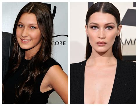 did bella hadid get a nose job see before and after photos of the model s alleged plastic surgery