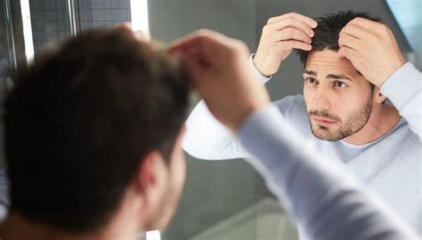 The Best Hair Loss Treatments For Men