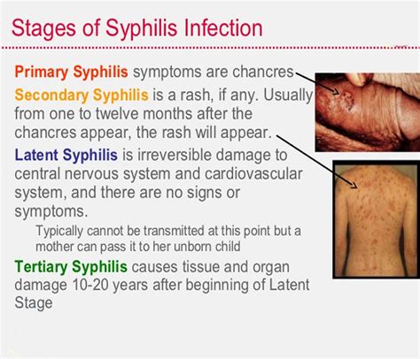 When syphilis affects the aorta in tertiary stage it may result in heart disease. Natural Therapy for Syphilis :: Galleria Health and ...