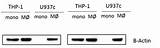 How To Use Loading Control In Western Blot Pictures