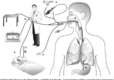 Pdf The Pathogenesis Of Ventilator Associated Pneumonia Its
