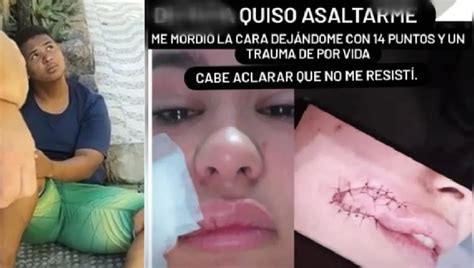 Justiça torna réu jovem que mordeu rosto de turista paraguaia durante