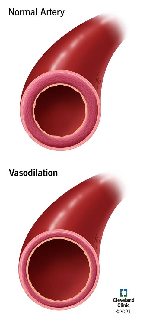 Vasodilation What Causes Blood Vessels To Widen