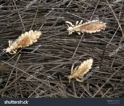 Body Lice Bites Images Stock Photos D Objects Vectors