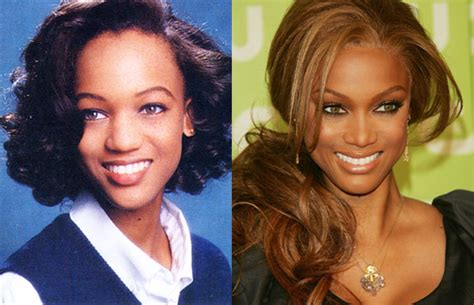 Tyra Banks Nose Job Plastic Surgery Before And After Celebie