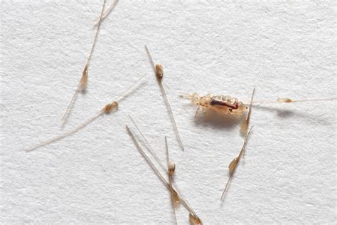 10 Fast Facts About Lice Eggs Lice Clinics Of Texas
