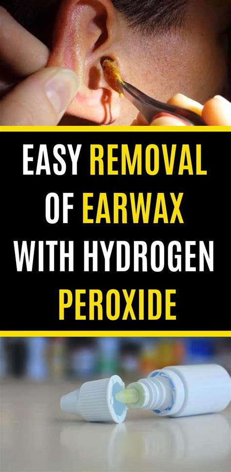 Easy Removal Of Earwax With Hydrogen Peroxide Ear Wax Clean Ear Wax