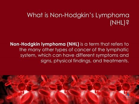 What Is Non Hodgkins Lymphoma Nhl Lymphoma Non Hodgkin Non