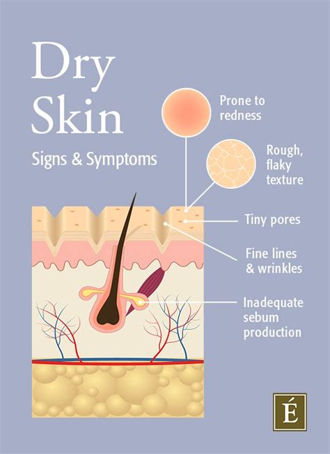 Ultimate Guide For Dry Skin Cause And Secret Treatments