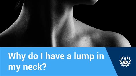 When Should I See A Doctor About A Lump In My Neck Youtube