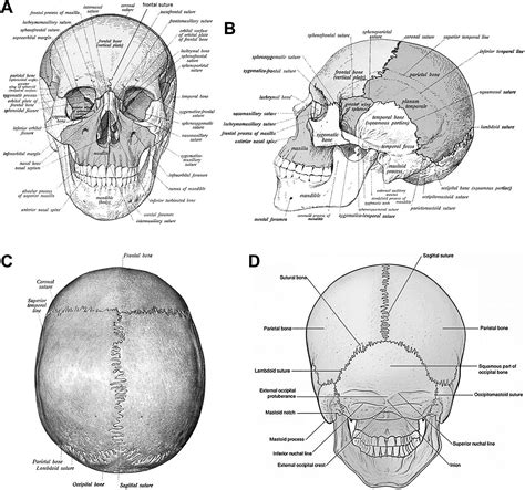 Cranial Suture Headache An Extracranial Head Pain Syndrome Originating