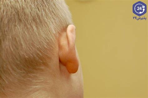 غده پشت گوش؛ علت و روش‌های درمانی پذیرش۲۴