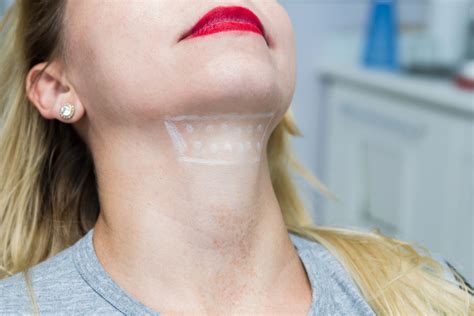 How To Reduce Sagging Jowls At Home Thebabcockagency