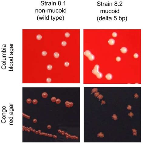 Morphology Of Non Mucoid And Mucoid S Aureus On Columbia Blood Agar