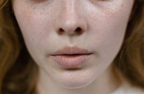 6 Surprising Causes Of Dry Scaly Skin — Cinderella Bridez