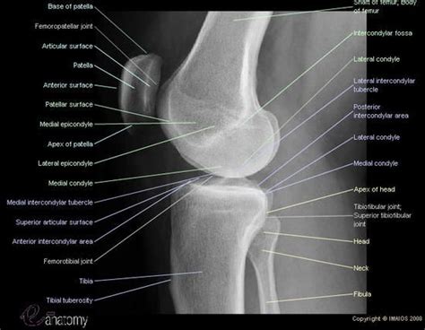 Parameters covered in the above test : radiological atlas of the lower limb : radiograph of the ...