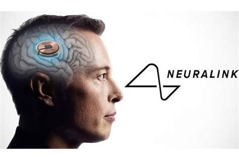 La 1ère Puce Neuralink Delon Musk A été Implantée Dans Un Cerveau Humain