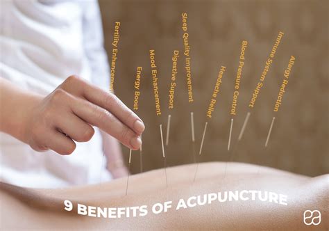 What Is Acupuncture How It Works And The Benefits Endoca© Cbd