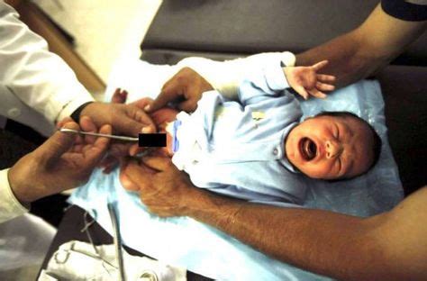 40 Best Circumcision Images Circumcision Circumcision Care
