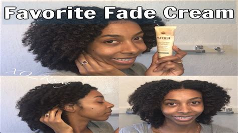 Ambi Fade Cream Review Fading Hyperpigmentation Youtube