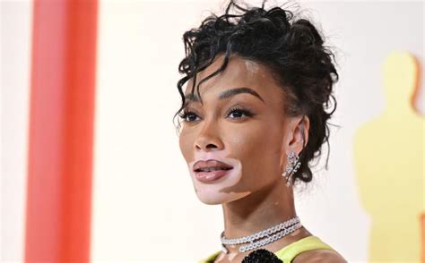 Winnie Harlow Looks Like Art In Flawless New Magazine Photos