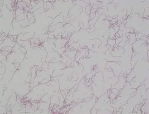 Figure 3b Nocardia Spp Gram Stain From Ba Plate Detection Of