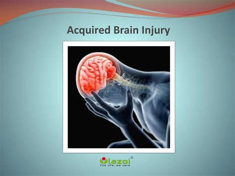 Ppt Acquired Brain Injury Causes Symptoms Diagnosis Risk Factor