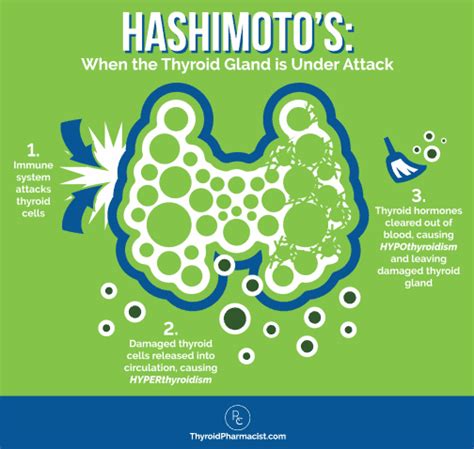 The Many Symptoms Of Hashimotos Dr Izabella Wentz