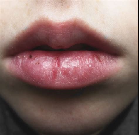 Lbumes Foto Que Significa Morderse Los Labios En Un Hombre Lleno