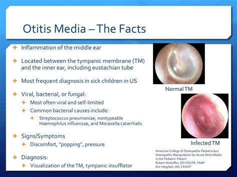 Ppt Pediatric Omt Powerpoint Presentation Free Download Id262088