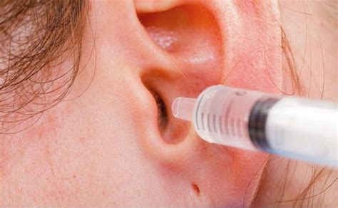 El Remedio Casero Para Eliminar El Exceso De Cerumen Del Oído