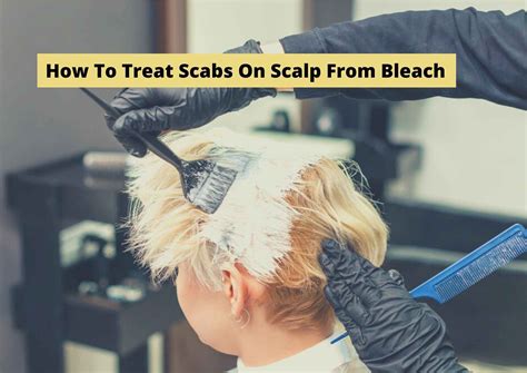 6 Tips On How To Treat Scabs On Scalp From Bleach 2022 Treatments For