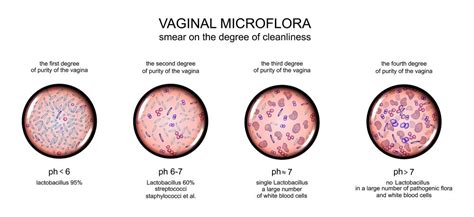 Causes Of A Bad Vaginal Odor Stdgov Blog