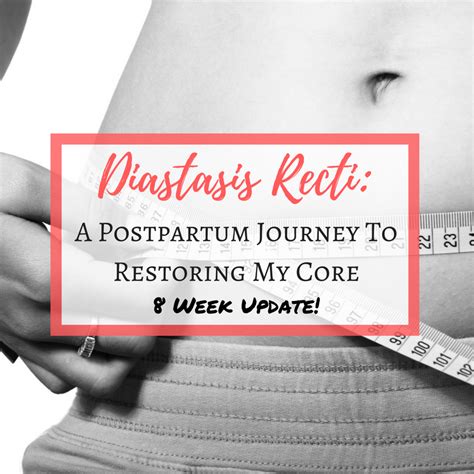 Healing My Postpartum Diastasis Recti Week 8 With Images Diastasis