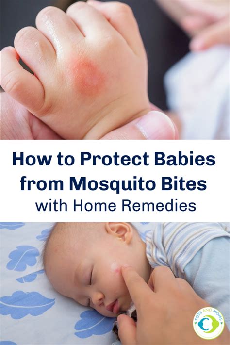 How To Protect Babies From Mosquito Bites And Home Remedies