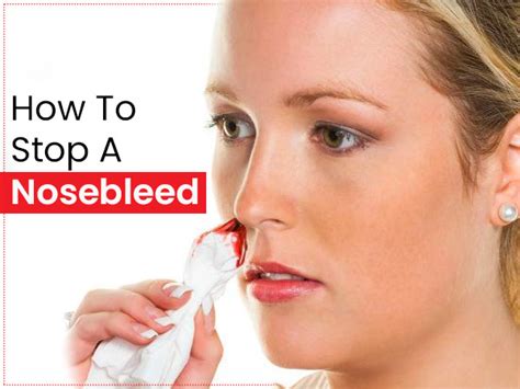 Having A Nosebleed Here S A Guide On How To Stop And Prevent It