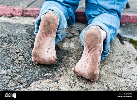 The Feet Of A Man Who Has Just Climbed Croagh Patrick Barefoot As He